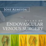 خرید و دانلود نسخه کامل کتاب Atlas of Endovascular Venous Surgery