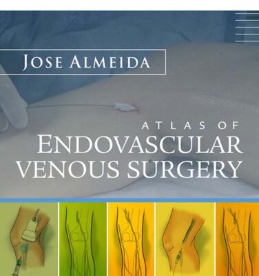 خرید و دانلود نسخه کامل کتاب Atlas of Endovascular Venous Surgery
