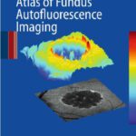 خرید و دانلود نسخه کامل کتاب Atlas of Fundus Autofluorescence Imaging