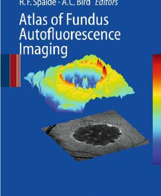 خرید و دانلود نسخه کامل کتاب Atlas of Fundus Autofluorescence Imaging