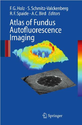 خرید و دانلود نسخه کامل کتاب Atlas of Fundus Autofluorescence Imaging_68bbdd6e810cd.jpeg خرید و دانلود نسخه کامل کتاب Atlas of Fundus Autofluorescence Imaging