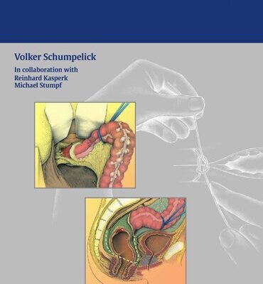 خرید و دانلود نسخه کامل کتاب Atlas of General Surgery