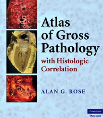 خرید و دانلود نسخه کامل کتاب Atlas of Gross Pathology: With Histologic Correlation