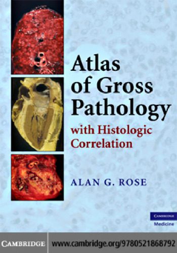 خرید و دانلود نسخه کامل کتاب Atlas of Gross Pathology: With Histologic Correlation_68b73409a6210.jpeg خرید و دانلود نسخه کامل کتاب Atlas of Gross Pathology: With Histologic Correlation