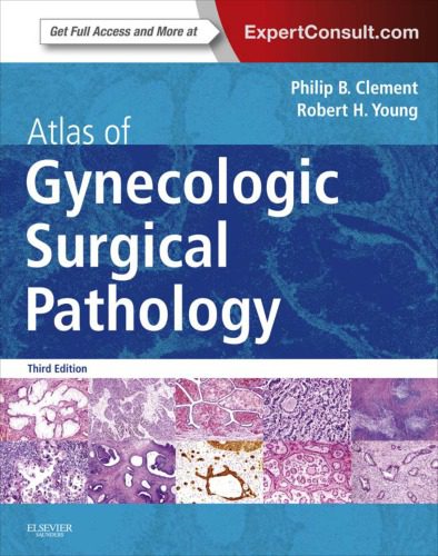 خرید و دانلود نسخه کامل کتاب Atlas of Gynecologic Surgical Pathology_68bc2a95119a9.jpeg خرید و دانلود نسخه کامل کتاب Atlas of Gynecologic Surgical Pathology