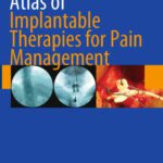 خرید و دانلود نسخه کامل کتاب Atlas of Implantable Therapies for Pain Management