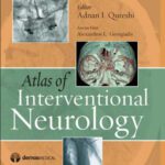 خرید و دانلود نسخه کامل کتاب Atlas of Interventional Neurology