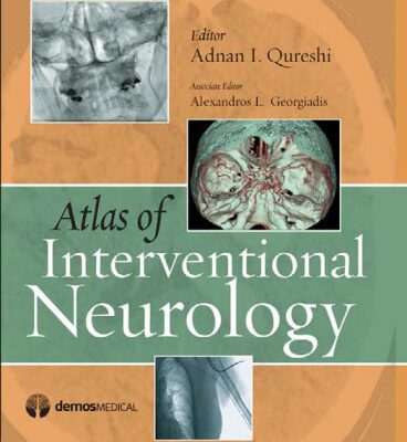 خرید و دانلود نسخه کامل کتاب Atlas of Interventional Neurology