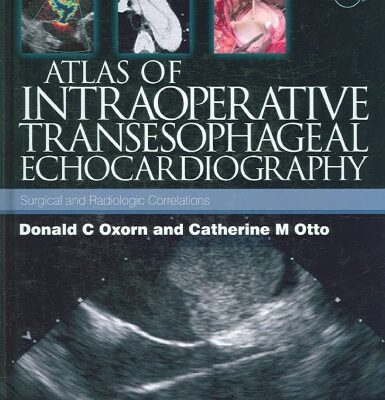 خرید و دانلود نسخه کامل کتاب Atlas of Intraoperative Transesophageal Echocardiography
