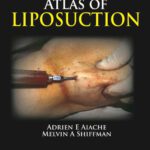 خرید و دانلود نسخه کامل کتاب Atlas of Liposuction