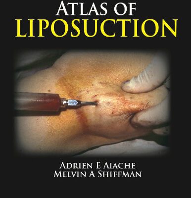 خرید و دانلود نسخه کامل کتاب Atlas of Liposuction