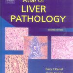 خرید و دانلود نسخه کامل کتاب Atlas of Liver Pathology, Second Edition (ATLAS OF SURGICAL PATHOLOGY)
