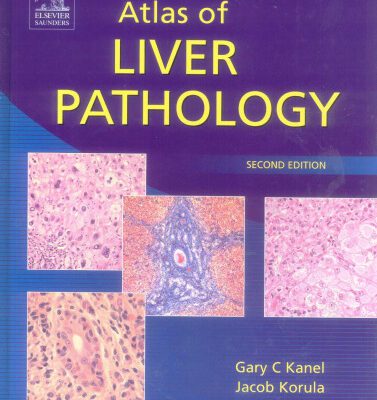 خرید و دانلود نسخه کامل کتاب Atlas of Liver Pathology, Second Edition (ATLAS OF SURGICAL PATHOLOGY)