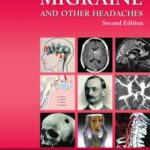 خرید و دانلود نسخه کامل کتاب Atlas of Migraine and Other Headaches
