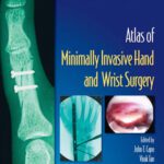 خرید و دانلود نسخه کامل کتاب atlas of minimal invasive hand and wrist surgery