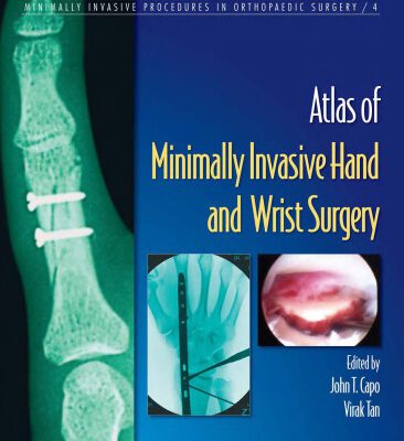 خرید و دانلود نسخه کامل کتاب atlas of minimal invasive hand and wrist surgery