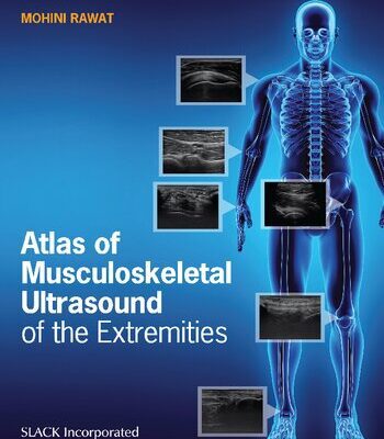 خرید و دانلود نسخه کامل کتاب Atlas of Musculoskeletal Ultrasound of the Extremities