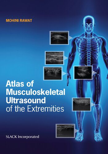 خرید و دانلود نسخه کامل کتاب Atlas of Musculoskeletal Ultrasound of the Extremities_68b6254613088.jpeg خرید و دانلود نسخه کامل کتاب Atlas of Musculoskeletal Ultrasound of the Extremities
