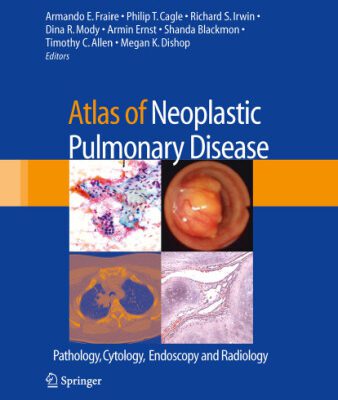 خرید و دانلود نسخه کامل کتاب Atlas of Neoplastic Pulmonary Disease: Pathology, Cytology, Endoscopy and Radiology