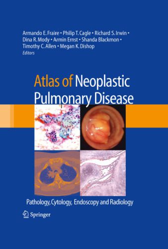 خرید و دانلود نسخه کامل کتاب Atlas of Neoplastic Pulmonary Disease: Pathology, Cytology, Endoscopy and Radiology_68b9a13a83d55.jpeg خرید و دانلود نسخه کامل کتاب Atlas of Neoplastic Pulmonary Disease: Pathology, Cytology, Endoscopy and Radiology