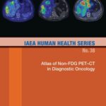 خرید و دانلود نسخه کامل کتاب Atlas of Non-FDG PET–CT in Diagnostic Oncology