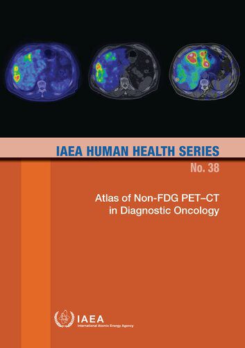 خرید و دانلود نسخه کامل کتاب Atlas of Non-FDG PET–CT in Diagnostic Oncology_68bb152e74a8b.jpeg خرید و دانلود نسخه کامل کتاب Atlas of Non-FDG PET–CT in Diagnostic Oncology
