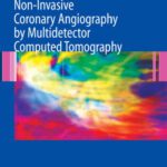 خرید و دانلود نسخه کامل کتاب Atlas of Non-Invasive Coronary Angiography by Multidetector Computed Tomography