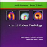 خرید و دانلود نسخه کامل کتاب Atlas of Nuclear Cardiology: Imaging Companion to Braunwald’s Heart Disease: Expert Consult – Online and Print – Orginal Pdf