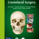 خرید و دانلود نسخه کامل کتاب Atlas of Operative Craniofacial Surgery