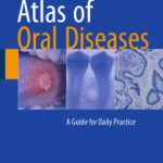 خرید و دانلود نسخه کامل کتاب Atlas of Oral Diseases: A Guide for Daily Practice