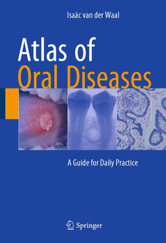 خرید و دانلود نسخه کامل کتاب Atlas of Oral Diseases: A Guide for Daily Practice_68bbf636e2377.jpeg خرید و دانلود نسخه کامل کتاب Atlas of Oral Diseases: A Guide for Daily Practice