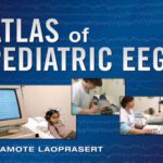 خرید و دانلود نسخه کامل کتاب Atlas of Pediatric EEG (Atlas Series)