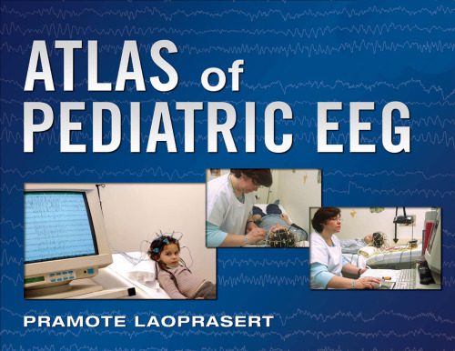 خرید و دانلود نسخه کامل کتاب Atlas of Pediatric EEG (Atlas Series)_68bb3a604fadf.jpeg خرید و دانلود نسخه کامل کتاب Atlas of Pediatric EEG (Atlas Series)