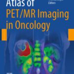 خرید و دانلود نسخه کامل کتاب Atlas of PET/MR Imaging in Oncology