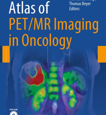 خرید و دانلود نسخه کامل کتاب Atlas of PET/MR Imaging in Oncology