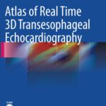 خرید و دانلود نسخه کامل کتاب Atlas of Real Time 3D Transesophageal Echocardiography