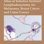 خرید و دانلود نسخه کامل کتاب Atlas of Selective Sentinel Lymphadenectomy for Melanoma, Breast Cancer and Colon Cancer