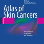 خرید و دانلود نسخه کامل کتاب Atlas of Skin Cancers: Practical Guide to Diagnosis and Treatment
