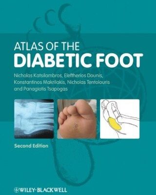 خرید و دانلود نسخه کامل کتاب Atlas of the Diabetic Foot, 2nd edition