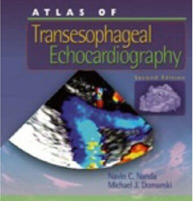 خرید و دانلود نسخه کامل کتاب Atlas of Transesophageal Echocardiography