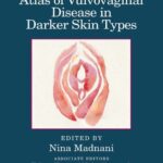 خرید و دانلود نسخه کامل کتاب Atlas of Vulvovaginal Disease in Darker Skin Types