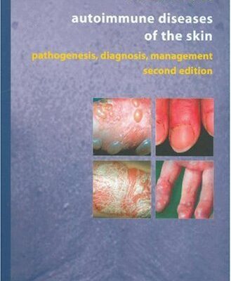 خرید و دانلود نسخه کامل کتاب Atypical Parkinsonian Disorders: Clinical and Research Aspects