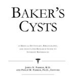 خرید و دانلود نسخه کامل کتاب Baker’s Cysts: A Medical Dictionary, Bibliography, And Annotated Research Guide To Internet References