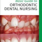 خرید و دانلود نسخه کامل کتاب Basic Guide to Orthodontic Dental Nursing (Basic Guide Dentistry Series)