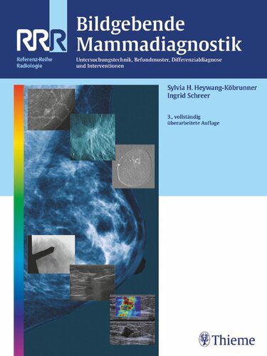 خرید و دانلود نسخه کامل کتاب Bildgebende Mammadiagnostik : Untersuchungstechnik, Befundmuster, Differenzialdiagnose und Intervention_68b5ab1ecd945.jpeg خرید و دانلود نسخه کامل کتاب Bildgebende Mammadiagnostik : Untersuchungstechnik, Befundmuster, Differenzialdiagnose und Intervention