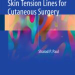 خرید و دانلود نسخه کامل کتاب Biodynamic Excisional Skin Tension Lines for Cutaneous Surgery