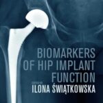 خرید و دانلود نسخه کامل کتاب Biomarkers of Hip Implant Function: Diagnostic Modalities to Prevent Chronic Periprosthetic Joint Infection and Implant Failure