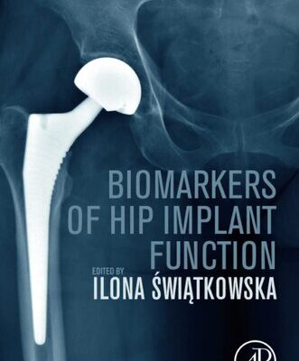 خرید و دانلود نسخه کامل کتاب Biomarkers of Hip Implant Function: Diagnostic Modalities to Prevent Chronic Periprosthetic Joint Infection and Implant Failure