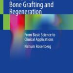 خرید و دانلود نسخه کامل کتاب Biophysical Osteoblast Stimulation for Bone Grafting and Regeneration: From Basic Science to Clinical Applications