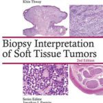 خرید و دانلود نسخه کامل کتاب Biopsy Interpretation of Soft Tissue Tumors